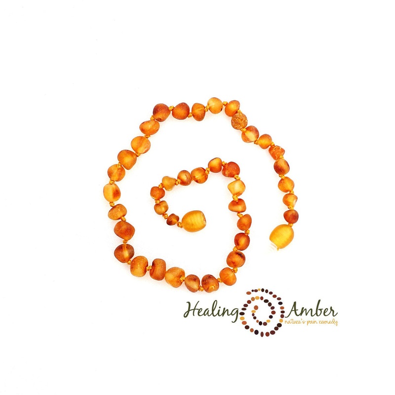 Raw Baltic Amber Teething Necklace – 11 inch