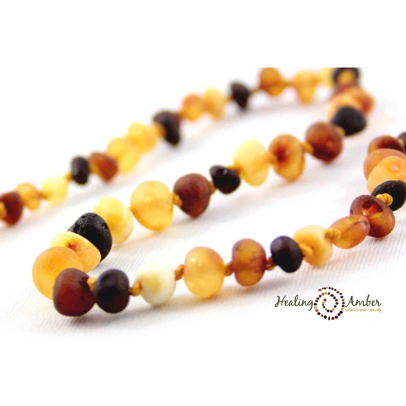 Healing Amber | 13″ Amber Necklace 13″ Glossy Amber & Rose Quartz
